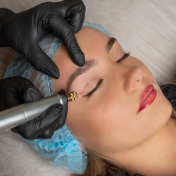 Plasma Pen Barcelona — Dr. Bermejo Pérez