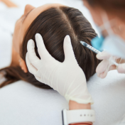 Minoxidil capilar Barcelona — Dr. Bermejo Pérez