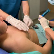 Micropigmentación cambio de sexo transgénero Barcelona — Dr. Bermejo Pérez