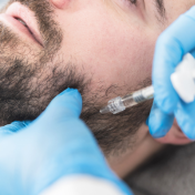 Marcación mandibular Barcelona — Dr. Bermejo Pérez